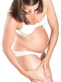 Varicosis vessels during pregnancy