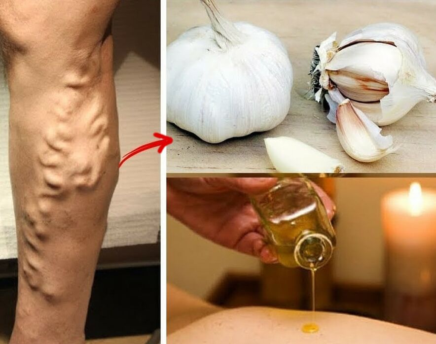 Drugs for varicose veins