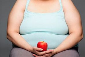 To treat varicose veins, you need to lose excess weight