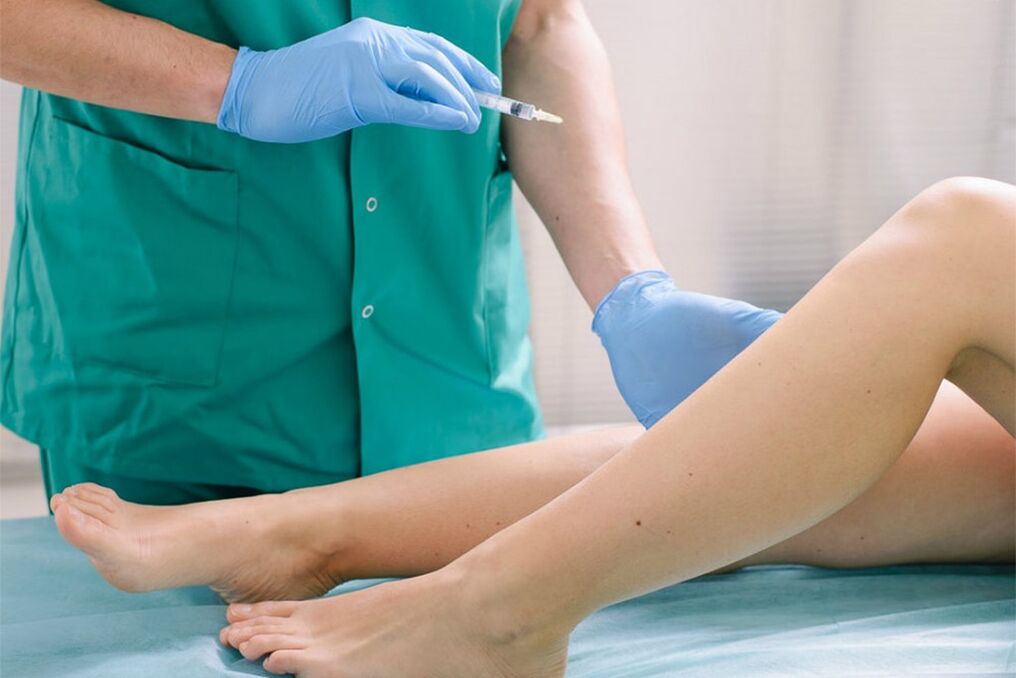 sclerotherapy to eliminate varicose veins