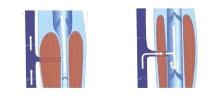 proper functioning of the venous pump