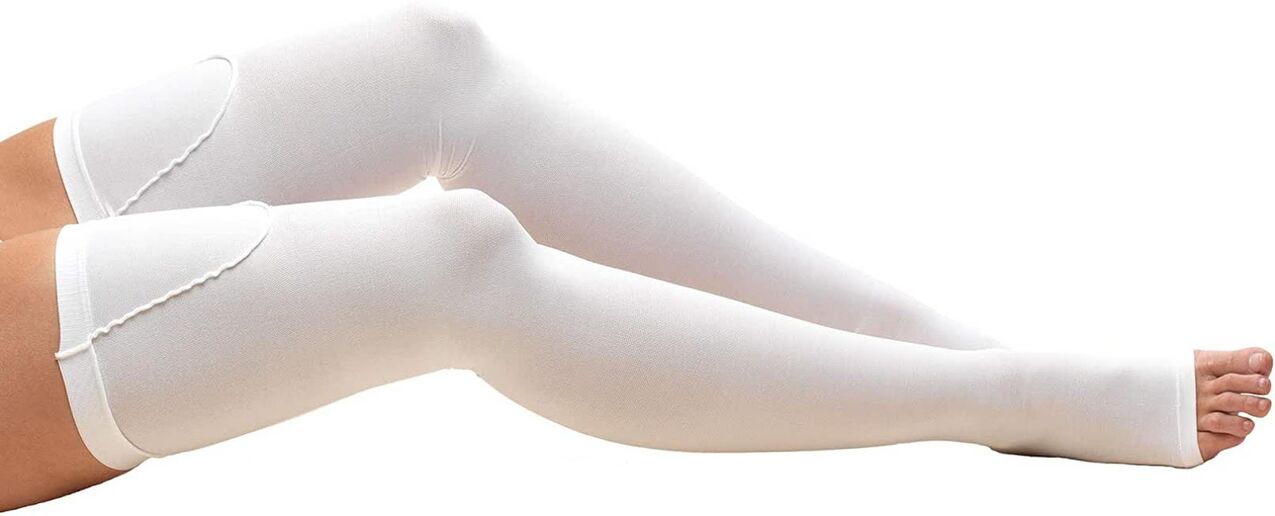 Compression stockings should be worn to treat varicose veins